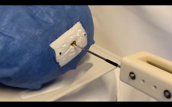 Needle insertion perfromed during live surgical robotics demonstration using custom-built Neuro-surgical robot.